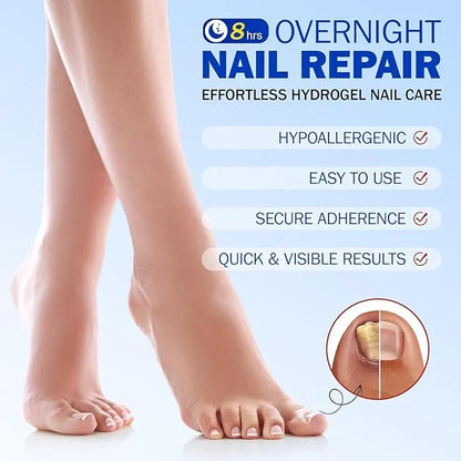Fungal Nail Treatment Patches – Fast-Acting Antifungal Repair for Healthy Nails