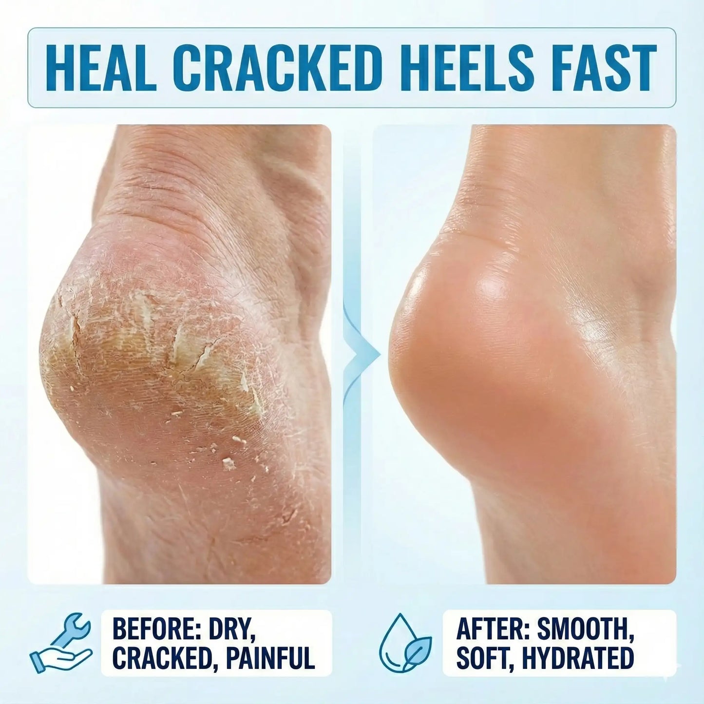 Heel Roll-On for Dry Feet & Cracked Heels
