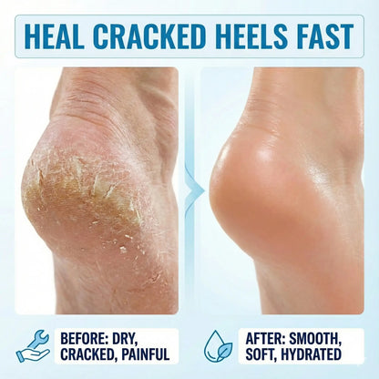 Heel Roll-On for Dry Feet & Cracked Heels