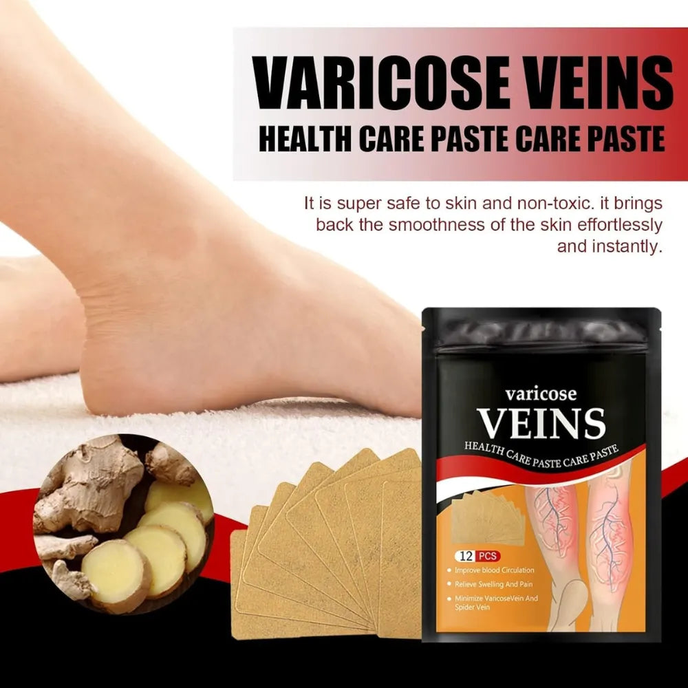 Varicose Veins Health Care Paste | Pain Relief & Blood Circulation Support