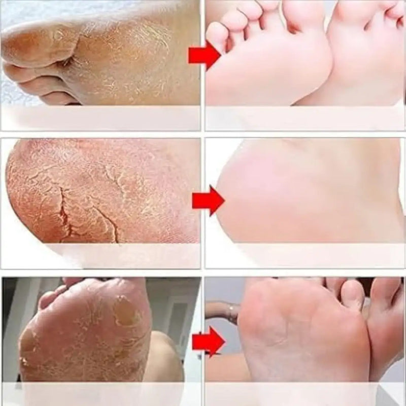 Goat Milk Exfoliating Foot Mask with Nicotinamide | Deep Moisturising & Dead Skin Removal Foot Mask