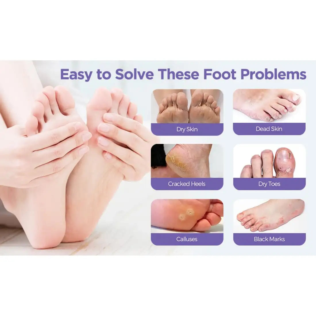 Goat Milk Exfoliating Foot Mask with Nicotinamide | Deep Moisturising & Dead Skin Removal Foot Mask